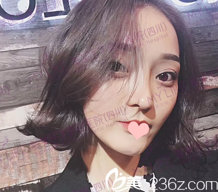 找四川美莱韩国栋做完鼻修复4个月 找四川美莱韩国栋做完鼻修复4个月