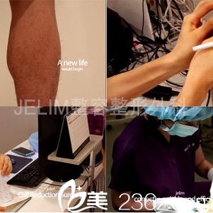 JELIM整形外科小腿医生李仁嬅 JELIM整形外科小腿医生李仁嬅