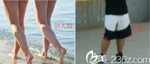 小腿粗是种什么样的体验