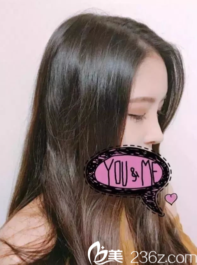 两周过去了,美美哒 两周过去了,美美哒