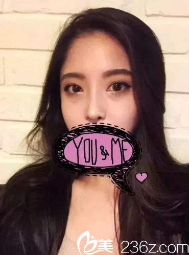 术后两个月左右 术后两个月左右