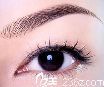 <!--<i data=20240703-sp></li>
<li><i data=20240703-sp></i>-->俏佳人电波拉皮除皱术