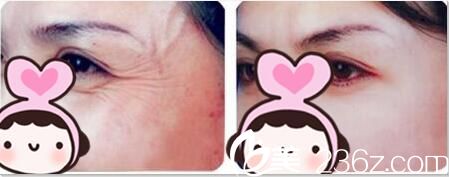 <!--<i data=20240703-sp></li>
<li><i data=20240703-sp></i>-->俏佳人熊师真人案例图