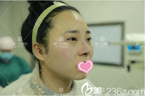 恢复一周后在样子 恢复一周后在样子