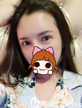 术后第七天 术后第七天