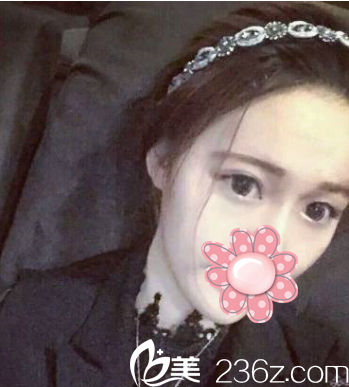 气色变好 气色变好