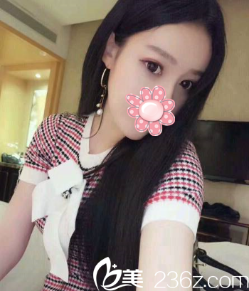 第32天完美蜕变 第32天完美蜕变