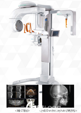 Pax Reve 3D CT Pax Reve 3D CT