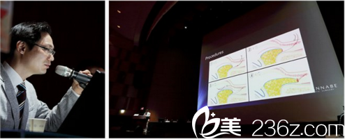 张院长发表眼底脂肪再排至演讲 张院长发表眼底脂肪再排至演讲