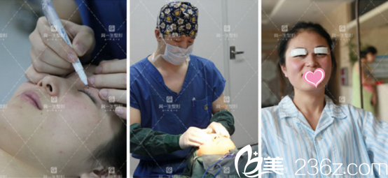 手术过程其实不疼 手术过程其实不疼