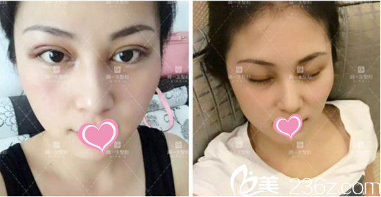 虽然没有恢复还是可以的 虽然没有恢复还是可以的