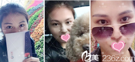 恢复的挺快的 恢复的挺快的