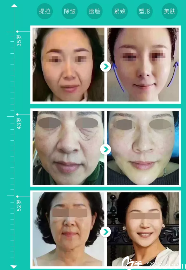 线雕医生石梅29日坐诊杭州瑞丽带你逆转光阴守住芳华