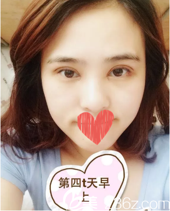 还是肿肿的 还是肿肿的