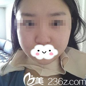 手术前的我 手术前的我