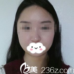 手术后七天 手术后七天