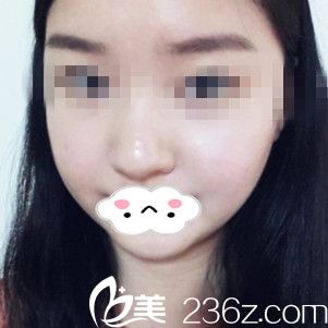 手术第十天 手术第十天