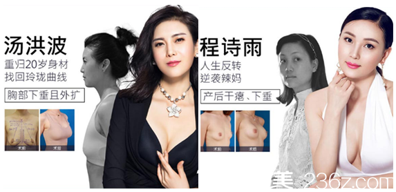 深圳美莱郭杰做的假体隆胸<span style= 深圳美莱郭杰做的假体隆胸<span style=