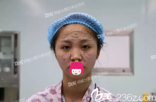 脸上爬满乌龟的赶脚 脸上爬满乌龟的赶脚