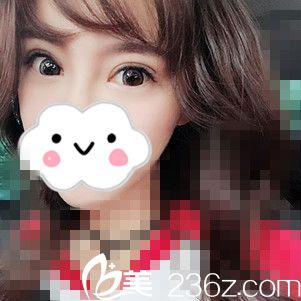 术后第15天的我