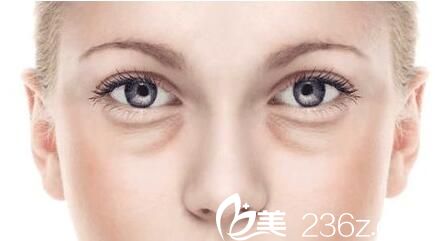 上海第九人民医院整形外科祛眼袋