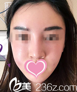 做完手术术后天 做完手术术后天