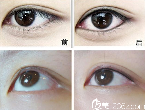 纪辉院长纹眼线真人<span style= 纪辉院长纹眼线真人<span style=