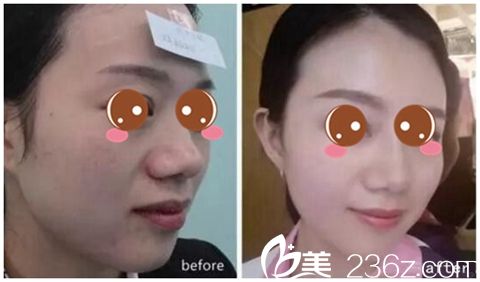 信阳东方艺隆鼻整形 信阳东方艺隆鼻整形