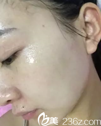 敷补水面膜 敷补水面膜