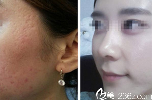 韩国陈整形外科医院院长陈世勋案例