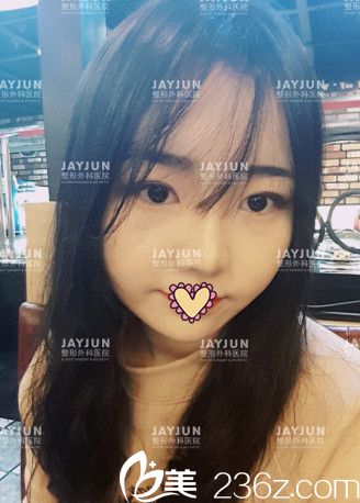 第八天了，恢复蛮不错