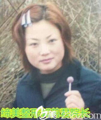 缔莱美整形院长郭芮君 缔莱美整形院长郭芮君