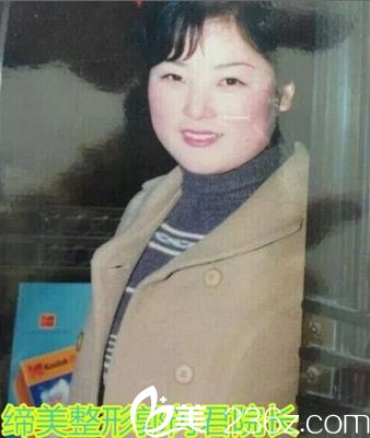 缔莱美整形院长郭芮君18岁照 缔莱美整形院长郭芮君18岁照