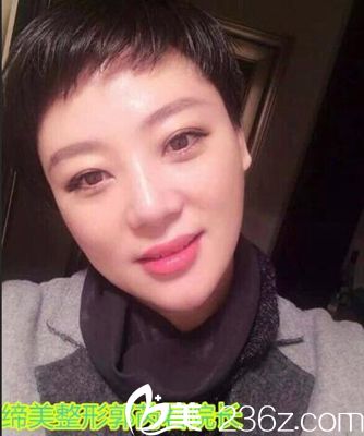 缔莱美整形院长郭芮君38岁照 缔莱美整形院长郭芮君38岁照