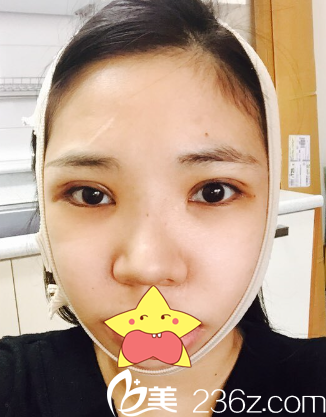 变小猪了 变小猪了