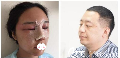 与<!--<i data=20240703-sp></i>-->面诊 与<!--<i data=20240703-sp></i>-->面诊