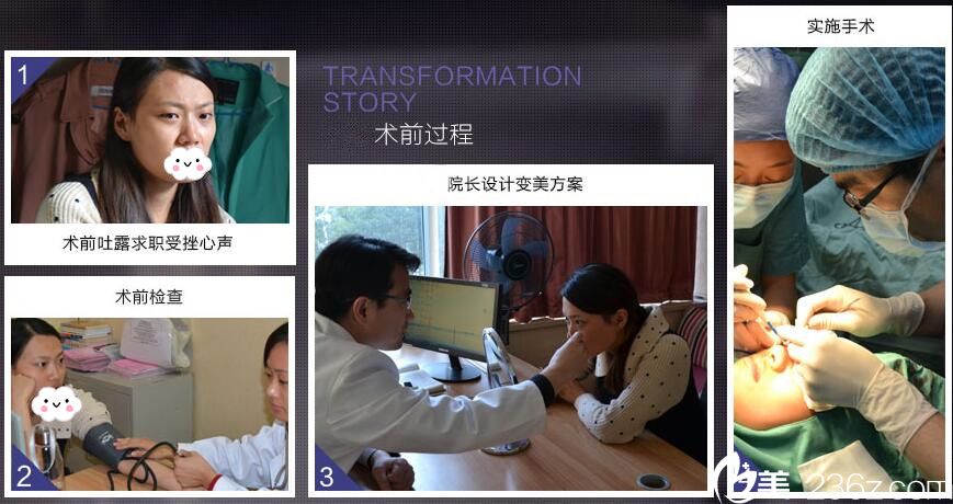 双眼皮+鼻综合手术过程 双眼皮+鼻综合手术过程