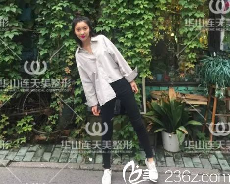 注射玻尿酸填充第7天旅行照片