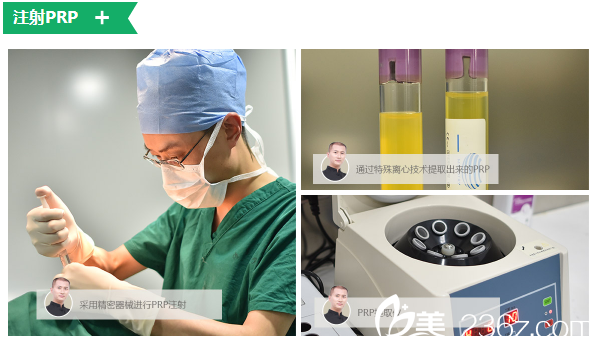 广州倍生植发采用精密器械进行PRP注射