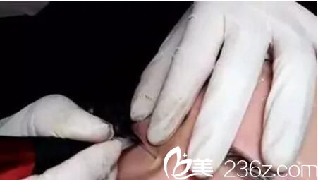 纹绣过程 纹绣过程