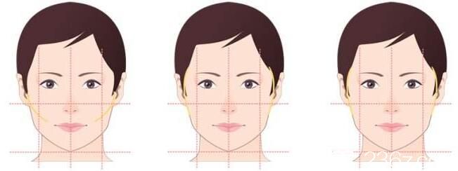 南宁韩星面部轮廓手术美学标准