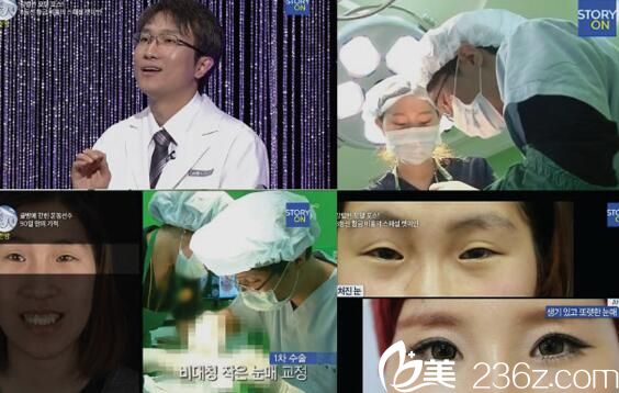 江南首延整形外科崔东一出演Let me in 4 江南首延整形外科崔东一出演Let me in 4