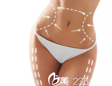 南宁自体脂肪移植哪好？南宁韩星自体脂肪填充16800元起帮你拥有童颜