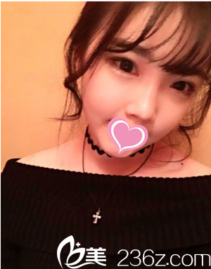 术后三个月 术后三个月