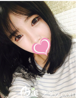 术后半年 术后半年