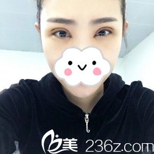 术后第五天 术后第五天