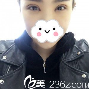 手术后第七天 手术后第七天