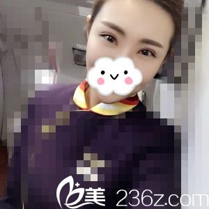 佳木斯韩艺来医疗美容医院谷永安医生让我重新拥有了美丽的眼睛