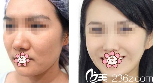 兰州明伦整形效果 兰州明伦整形效果