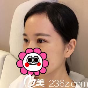 术后8天效果 术后8天效果